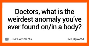 15 Doctors Share the Weirdest Things They've Ever Found in a Human Body