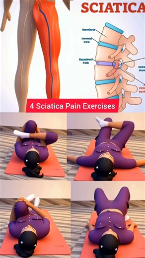 🔥Sciatica Pain Relief | Best Exercises for Sciatica 💪 | Sciatica Nerve Pain Treatment at Home 🏠