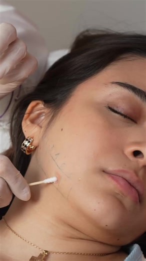 ASMR Skincare Allergy Testo | Doctor Roleplay, Patch Testing, Gentle Attention & Light Triggers #asmrrealperson #asmrrelax #allergytest #drivy #ivyasmr #roleplay #asmrreels #reelsinstagram