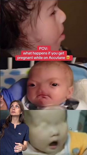 What Happens If You Get Pregnant on Accutane?