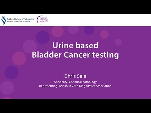 How tests help patients - Urine based Bladder Cancer testing