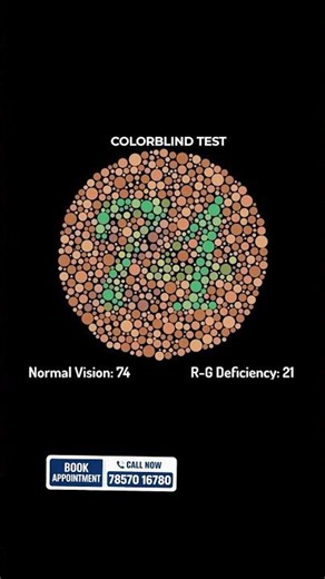Eye Color Vision Test 👀 | Aap Kitna Sahi Guess Kar Paoge? #kumarnetralaya