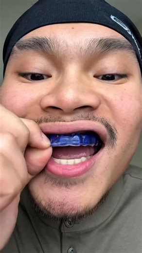 Coffee, tea, and daily stains can slowly dull your smile. Smileé Strips mold comfortably to your teeth to help lift surface stains while staying gentle on enamel. Just apply, wait 30 minutes, and reveal a brighter smile. | Smileé Lab