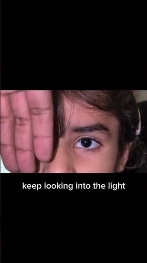 left Esotropia on Cover Uncover test/Squint Examination #optometry #eyecare#ophthalmology