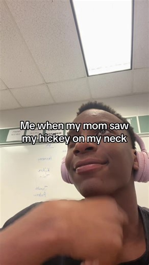 #relatable #fyp | neck scar