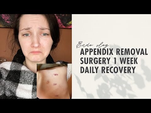 Appendix Removal Surgery 1 Week Daily Recovery