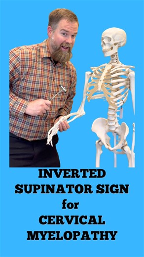 Matt, PT, Dip MDT, FAAOMPT on Instagram: "The inverted supinator sign was first described in 1910 by Joseph Babinski (Babinski, J. (1910). Inversion du reflexe du radius. Bulletin et Memoires de la Societe de Medecine des Hopitaux de Paris, 30, 185-186) and it is a way to diagnose a lesion at the C5-C6 spinal cord level meaning that if it’s positive there could be an upper motor lesion. What this is looking at is the reflex of the brachioradialis tendon but if there is that upper motor issue goi