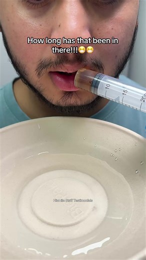 Review of Hismile Mouthwash: Does It Work?