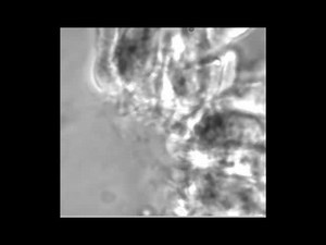 File:LRRC6-Mutation-Causes-Primary-Ciliary-Dyskinesia-with-Dynein-Arm-Defects-pone.0059436.s003.ogv - Wikimedia Commons