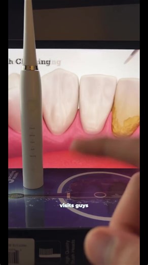 Plaque Remover for Teeth,Tartar Remover for Teeth Cleaning with 3 Replaceable Heads and 5 Adjustable Modes,Rechargeable Teeth Cleaning Plaque Remover for Home