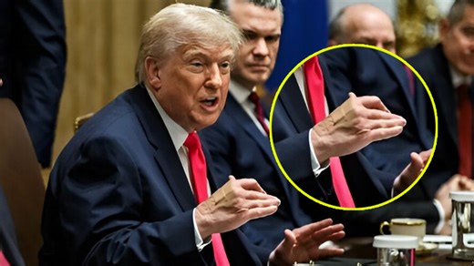 Donald Trump’s 24-hour absence sparks wild theories after he is seen with new bruises