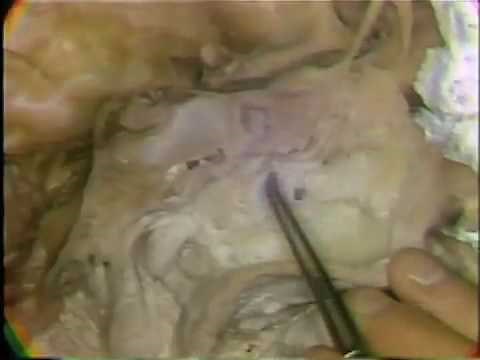 Gross Anatomy: Nasal Cavity
