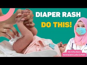 Baby Diaper Rash Treatment | How to Cure It Fast at Home | Dr Hina Baig