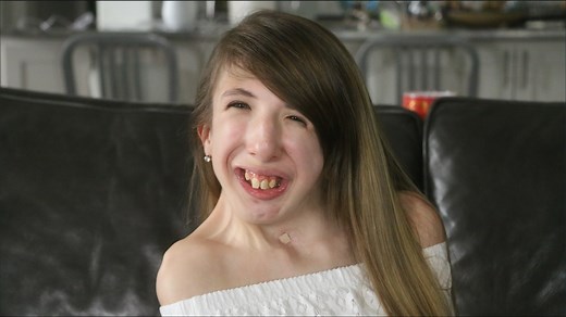 932K views · 18K reactions | Grace is diagnosed with a rare condition known as Escobar syndrome. After over 30 surgeries and countless hours of physical therapy she is able to participate in her favorite activity, playing the piano. | Special Books by Special Kids | Facebook