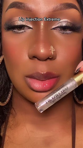 Extreme Lip Injection: Does it Really Work?