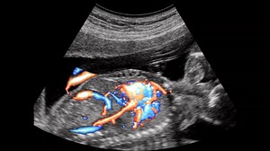 19K views · 66 reactions | Assessing blood flow through the fetal heart and brain is an important part of every #ultrasound exam. MV-Flow™ and LumiFlow™ technology in our #Hera W10 can be used independently or in combination with each other to help assess both fetal and maternal circulation. | Samsung Healthcare USA | Facebook