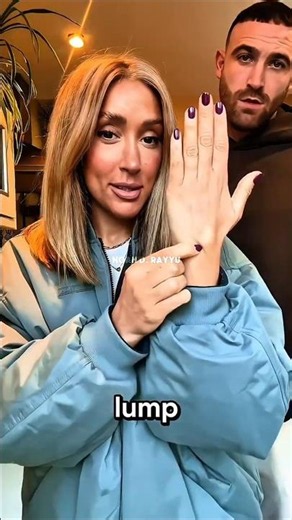 Don't Ignore This Lump on Your Hand‼️😱