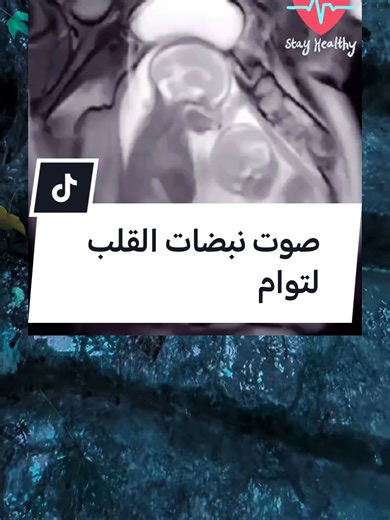 صوت نبضات القلب لتوام #creatorsearchinsights #سبحان_الله #توام #جنين #معلومات_طبية #صحه #اكسبلور #foruyou #for #viralllllll #معلومات_غريبة #صحه_عامه #نبضات#قلب