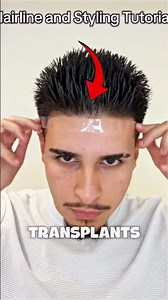 How To Have The Perfect Hairline