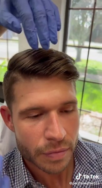 Men's Botox Trends: Rise in Aesthetic Procedures for Men