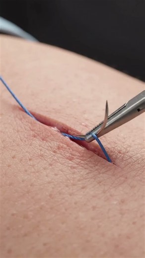 Inside Surgical Skin Suturing 🩹 | Medical 3D Animation in 8K #Shorts