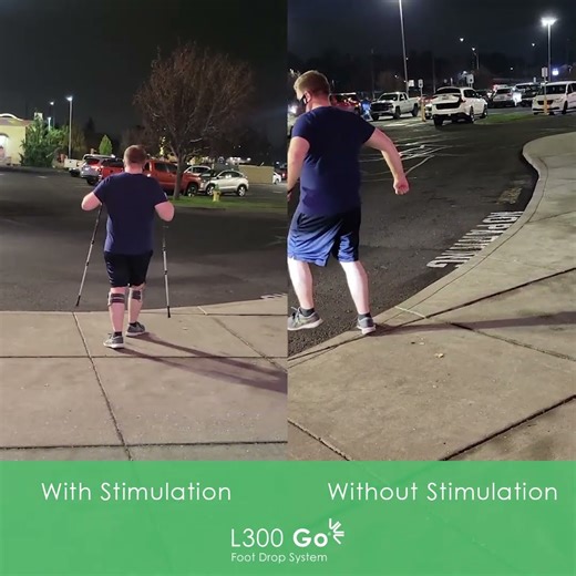 Foot Drop Before & After: L300 Go Functional Electrical Stimulation Results