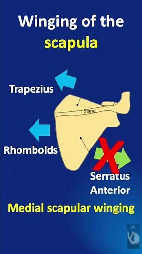 Shorts # 163: Winging of the scapula - what is it, why does it occur, what are the different types?