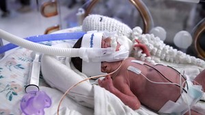 Hospital uses hand-crocheted octopuses to help NICU babies feel safe