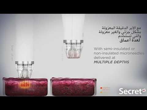 Secret RF - Micro-Needle Fractional RF System