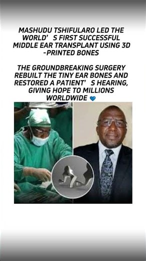 Doctor Makes History with 3D Ear Surgery 🧠🦻 #viral #health
