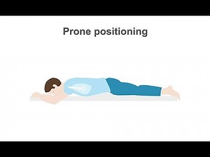 How to treat your intubated ARDS patients with prone positioning