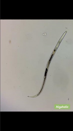 A nematode.From freshwater.#Nematode #microscope #undermicroscope