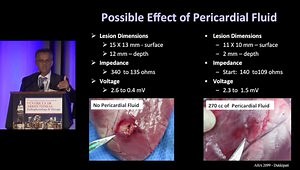 How To Perform Epicardial Mapping and Ablation