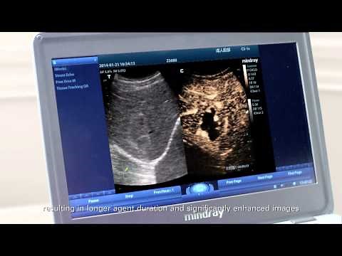 M9 Ultrasound System - the device