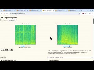 AI vs. Clinician: High-Accuracy Seizure Detection with CNN on EEG Data