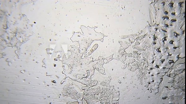 Demodex mite with zoom-in view at 100x (brightfield)