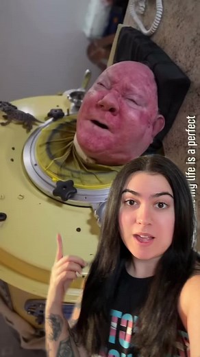 #polio #paulalexander #ironlung | Iron Lung