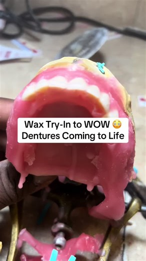 Wax Try-In to WOW 😳 Dentures Coming to LifeWax try-in check ✅ Making sure the bite, smile line, and tooth setup look right before the final finish. One step closer to a brand new smile. #DentureLab #WaxTryIn #Dentures #DentalLab #SmileMakeover