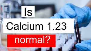 Is Serum Calcium 1.23 low, normal or dangerous? What does Serum Calcium level 1.23 mean?