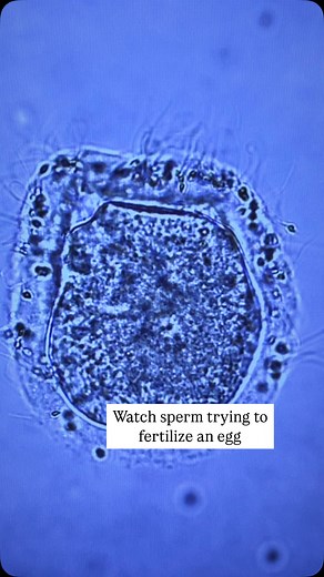 977K views · 1.4K reactions | Before fertilization can occur, sperm...