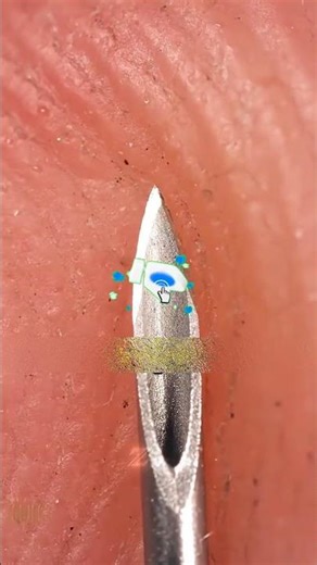 Can Glass From an Ampule Enter Your Injection?