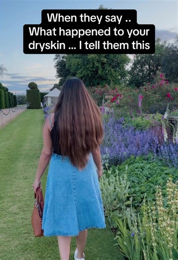 Used to have dry elbows and cracked heels .. but now I’m wearing my summer wardrobe with skin feeling like a goddess.. and my skin care was 100% natural and didn’t break the bank to buy.. Link in bio. #dryskinremedy #sensitiveskinfix #naturalbalm #dryskincareroutine #skincareroutine #flareups