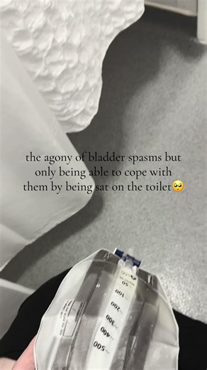 Understanding Sacral Neuromodulation for Bladder Spasms