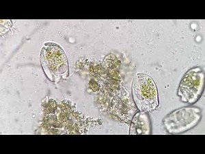 Rumen Fluid - Bustling City