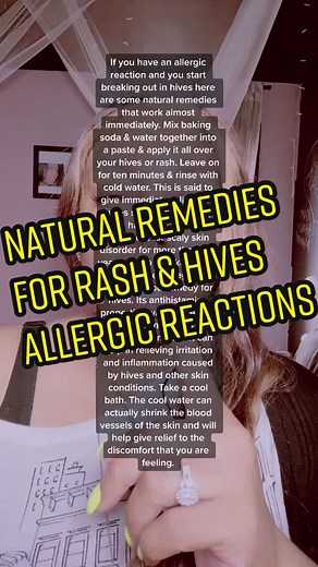 Natural Remedies for Rash & Hives: Immediate Relief Techniques