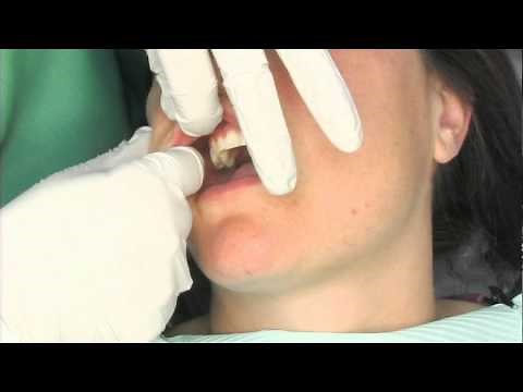 Oral Cancer Screening Exam