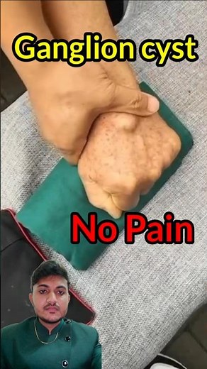 ganglion cyst #ganglioncyst #tumor #synovialfluid #joint