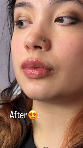 SC| Aesthetics practitioner|SPMU🩷💉 | Before & After lip filler results😍0.8ml lips🫦 Reference: Russian lips If viewing follow @scaestheticss_ @scbeautique_ for more - - -... | Instagram
