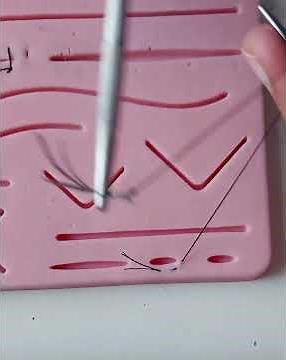 Purse String Suture Technique