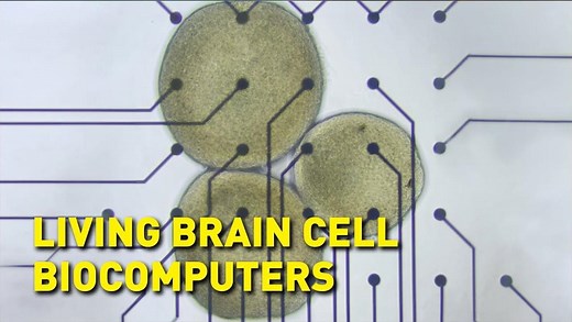 Biocomputers made from human brain cells could run the AI systems of the future – Lifeboat News: The Blog